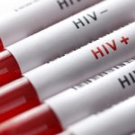 Working to Capture 270,000 HIV persons not on reatment says FG
